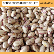 Sugar White Light Kidney Beans Supplier